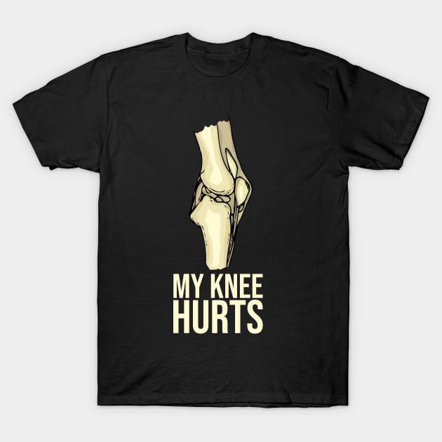 Knee Replacement Recovery Gift New Joint Surgery Knee T-Shirt by PomegranatePower